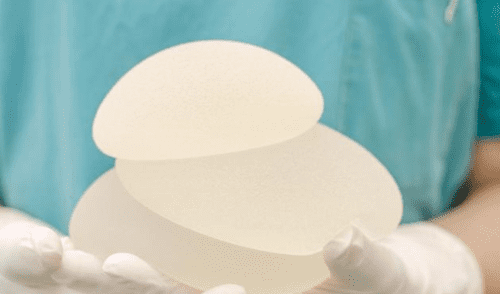 Brasil prohíbe uso de implantes mamarios y glúteos tras encontrar 47 irregularidades de riesgo mayor Brasil prohíbe uso de implantes mamarios y glúteos tras encontrar 47 irregularidades de riesgo mayor