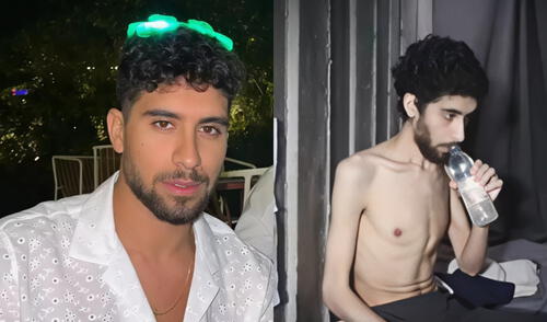 Evyatar David, el joven israelí secuestrado por Hamás, luce irreconocible tras meses en cautiverio.