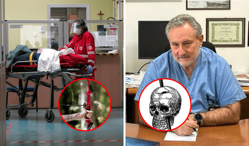 Hombre de 64 años sobrevive tras permanecer dos días con flecha en su cabeza.