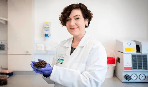 Alexandra Morton-Hayward colecciona cerebros para revelar los secretos de la materia gris.