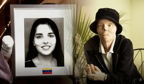 Jacqueline Saburido sufrió un accidente que le cambió la vida el 19 de septiembre de 1999, en Estados Unidos.