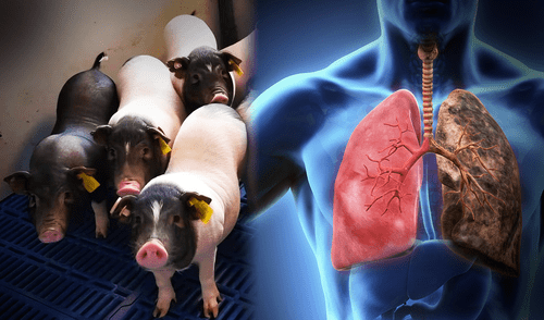 Científicos chinos hacen historia con el primer trasplante de pulmón de cerdo a un humano en estado de muerte cerebral