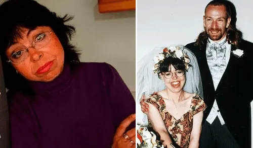 Michelle Philpots, la mujer de Inglaterra que tras un accidente de auto pierde la memoria al dormirse