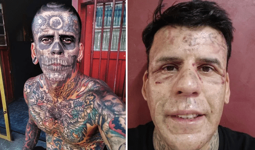 Leandro de Souza tuvo que atravesar un duro proceso de cirugía para eliminar sus 170 tatuajes en todo el cuerpo.