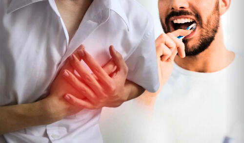 9 de cada 10 peruanos tienen caries, según el Ministerio de Salud