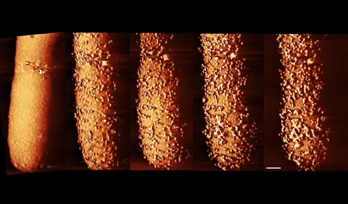 El antibiótico obliga a las bacterias a desprenderse de su armadura externa y permite que el medicamento se infiltre.