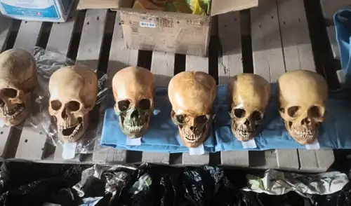 El intervenido en Cusco sostiene que los cráneos eran para estudios odontológicos, aunque la investigación sugiere un posible tráfico de bienes culturales.