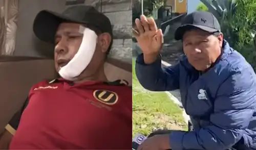 Adulto mayor sufre corte en su rostro al defender a su hija