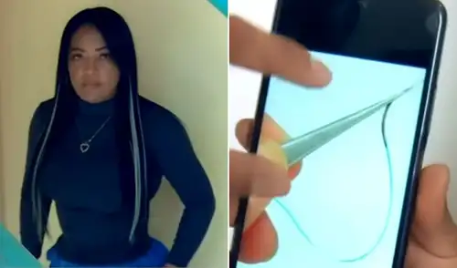 Paciente denuncia a falsos cirujanos por dejarle una aguja en el cuerpo tras operación: no estarían registrados en el Colegio Médico La víctima denuncia negligencia médica tras una cirugía estética y asegura haber sufrido intensos dolores, secreciones y complicaciones durante tres meses.