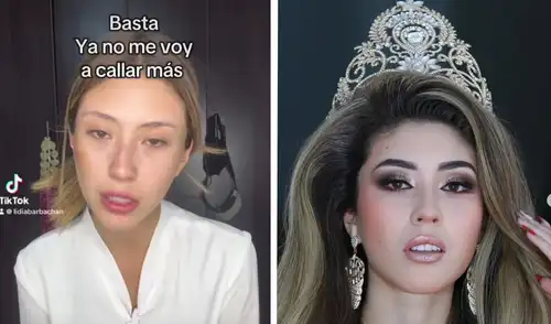 Miss Arequipa denunció a su expareja por agresión Foto: Composición LR