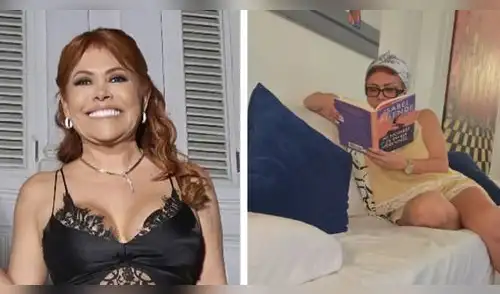 Magaly Medina compartió detalles de su proceso de recuperación tras cirugía facial. Magaly Medina compartió detalles de su proceso de recuperación tras cirugía facial.