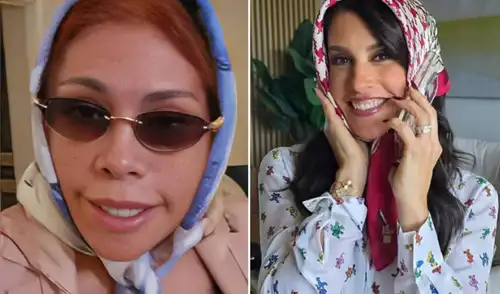 La periodista Magaly Medina viajó a Argentina para someterse a la compleja técnica del deep plane lifting.