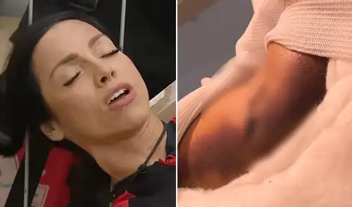 Paloma Fiuza reveló fuertes imágenes de su lesión en 'El internado'.