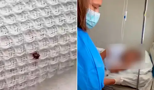 La respuesta del personal fue retirar la ropa de cama y trasladar a la paciente de la sala de emergencia de EsSalud de Nuevo Chimbote a una silla.