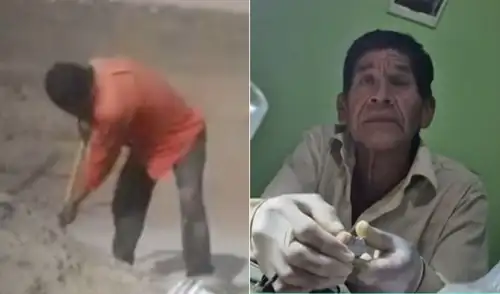 Alejandro Romero Piñas reveló que también ejerce de dentista en la selva peruana.