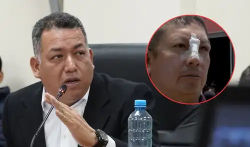 Ciudadano habría sido agredido tanto por la seguridad del congresista como por el propio parlamentario