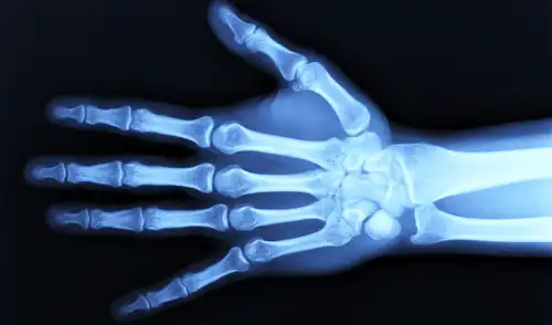 Una nueva investigación reveló un enfoque prometedor para la regeneración del cartílago. Foto: IStock