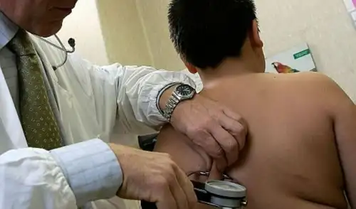 Especialistas alertan sobre los riesgos de la obesidad infantil: enfermedades crónicas y afectaciones a largo plazo