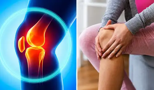 La alternativa que podría cambiar el tratamiento de la artrosis de rodilla: alivió el dolor durante un año con una sola intervención