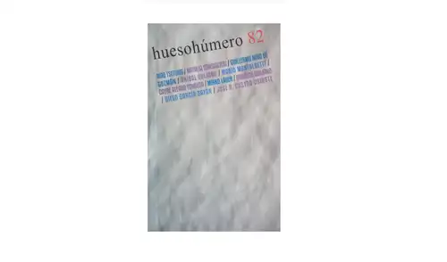 Hueso Húmero 82. Imagen: Difusión.