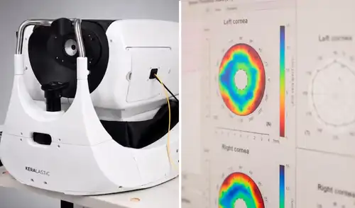 La nueva tecnología para prevenir la ceguera ya está en fase clínica. La nueva tecnología para prevenir la ceguera ya está en fase clínica.