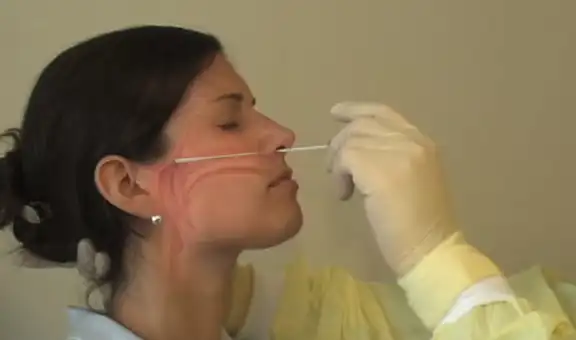 Mujer sufrió pérdida de líquido cerebral tras una prueba de hisopado en EE. UU.