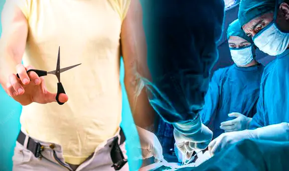 Vasectomía gratis en Perú: ¿es reversible después de la cirugía y se puede volver a la normalidad?