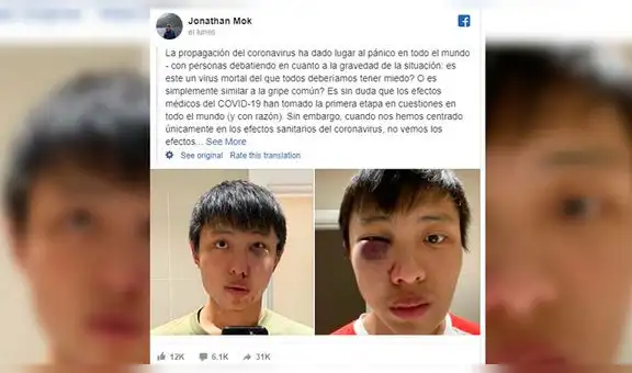 “No quiero tu coronavirus en mi país”: joven asiático sufre brutal golpiza en Inglaterra [FOTO]