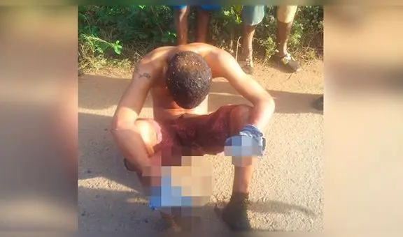 Arrancaron ojos, lengua y manos de soldado de 19 años en una mina en Venezuela