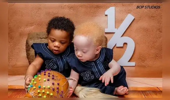 Bebés mellizos con diferente color de piel y cabello sorprenden al mundo [FOTOS]