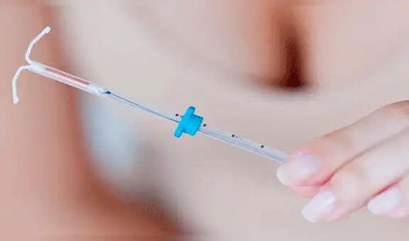 Métodos anticoncepivos: hospitales donde puedes recibirlos gratuitamente