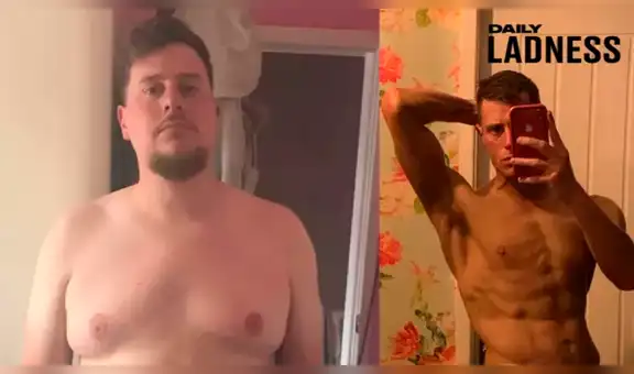Joven sufrió por enfermedad que casi le cuesta su vida y ahora cautiva a miles con su renovada apariencia [FOTOS]