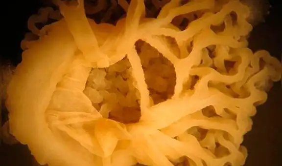 Argentina: descubren bacteria que puede prolongar la vida