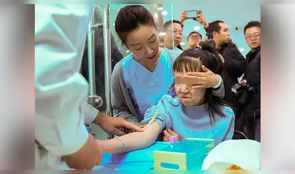 Joven de 15 años con apariencia de 60 se somete a cirugía y queda irreconocible [VIDEO]