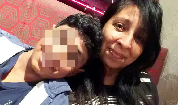Bullying criminal: escolares lanzan queso a un compañero que era alérgico a los lácteos