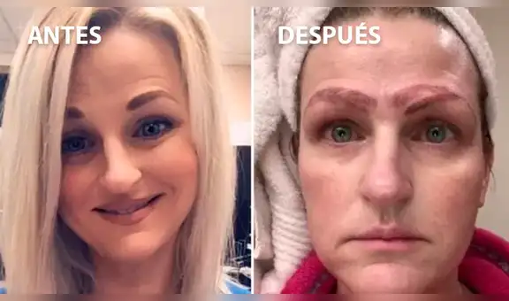 Facebook viral: así quedó una mujer que se sometió a un tratamiento de tatuaje de cejas [VIDEO]