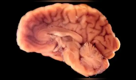 Científicos descubren la forma de revivir el cerebro del humano [FOTOS]