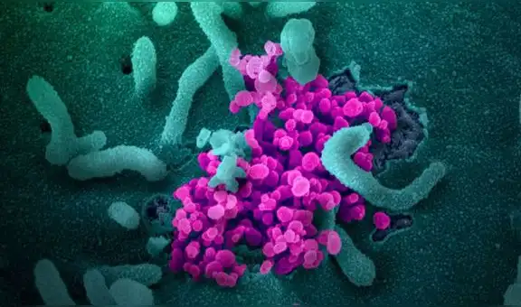 Brasil identifica medicamento que detiene reproducción del coronavirus