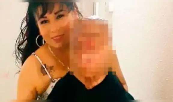 “No soy zombi": La conmovedora historia del joven desfigurado en incendio que lucha para ver por primera vez
