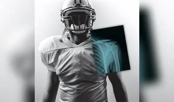 Conoce la tecnologia que ahora aportará a la medicina deportiva