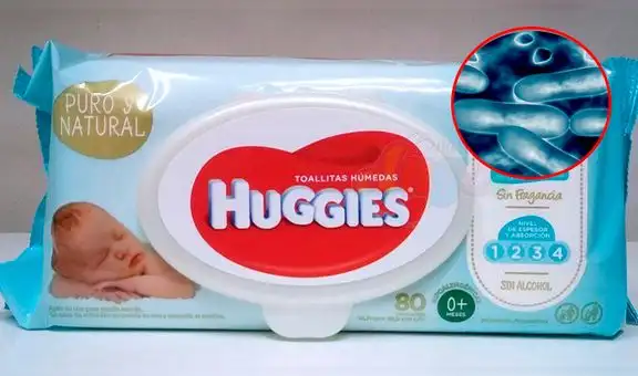 Toallitas húmedas Huggies: ¿Qué tan peligrosa es la bacteria que contaminó esos productos?