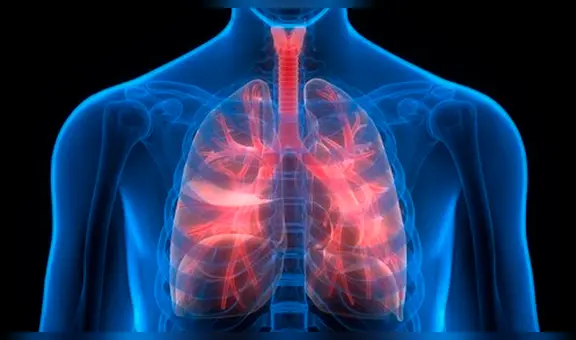 Fibrosis pulmonar: ¿Qué le sucede al órgano cuando se presenta la enfermedad?