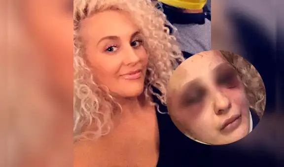 Mujer estuvo en coma por cuatro semanas tras sufrir ataque de su expareja