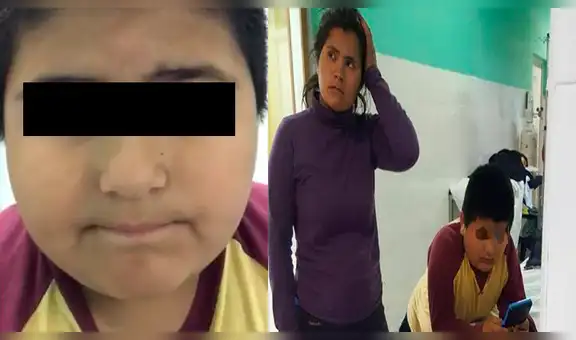 Facebook: niño se traga un silbato y su forma de hablar sorprende en Internet [VIDEO] 
