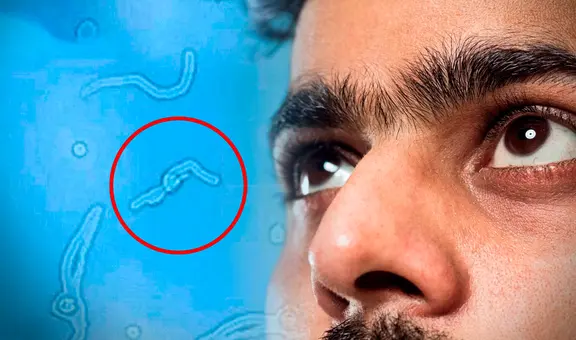 ¿Por qué sueles ver ‘gusanitos’ en tu campo visual? Esto dice la ciencia