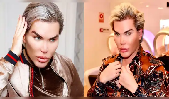 Instagram: Ken humano se somete a su más dolorosa operación [FOTO]