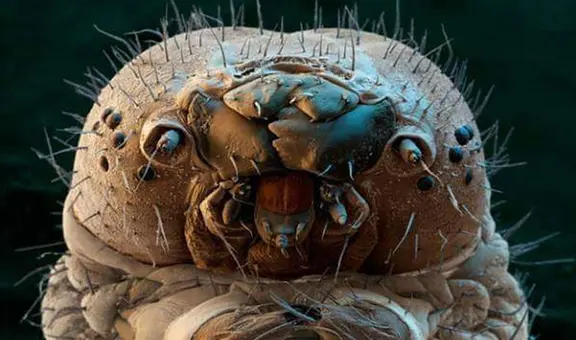 Imágenes microscópicas revelan cómo son los parásitos que tienen sexo en nuestras caras