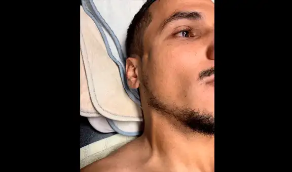 Zlatan Ibrahimovic provocó la fractura de un cráneo tras fulminante codazo [VIDEO]
