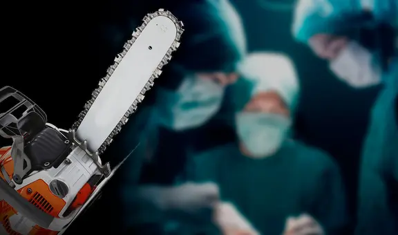 ¿Sabías que la motosierra no fue inventada para cortar madera?