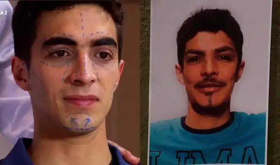 “Al fondo hay sitio”: ¿Jimmy será el nuevo ‘Cara de pez’? Cirugía plástica promete hacerlo guapo